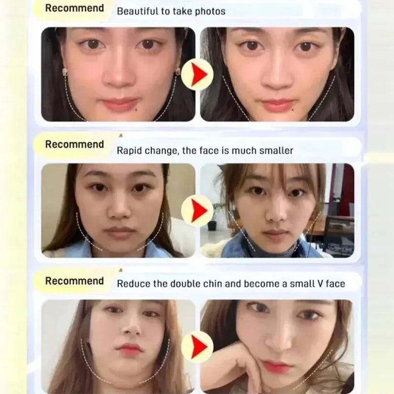 Cheek Slimming Bandage